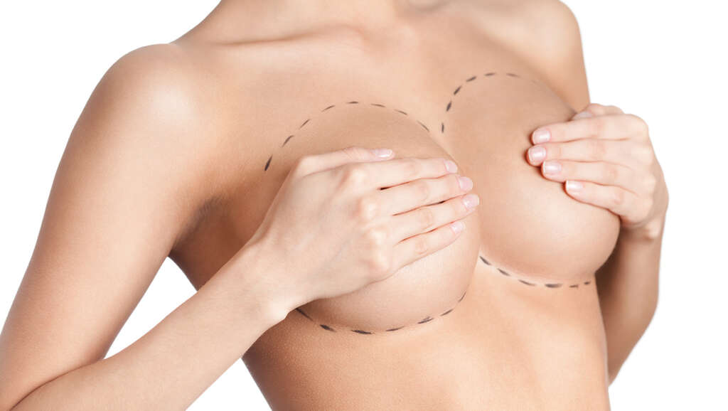 Pall Mall Medical - What is Breast Reduction Surgery? 👇 This procedure  reshapes and reduces heavy breasts. It involves the removal of excess breast  glands, breast fat and excess skin. This achieves