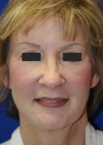 A woman with short hair and a closed smile. Her eyes are obscured by black rectangles.