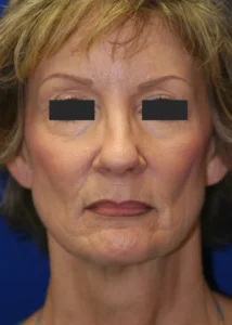 A portrait of an older woman against a blue background with black rectangles obscuring her eyes.