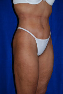 Person in white underwear stands against a blue background showing a side view of their midsection and thighs.