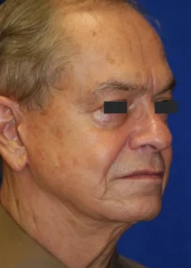 Older man with gray hair and visible wrinkles on face, eyes covered by black bars for anonymity, against a blue background.