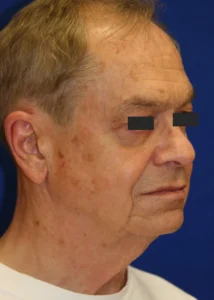 Elderly man in profile view with a neutral expression and obscured eyes, wearing a white shirt against a blue background.