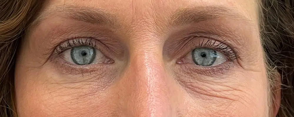 Close-up of a person's face focused on their blue eyes, with visible details of eyelashes, eyebrows, and some wrinkles around the eyes.