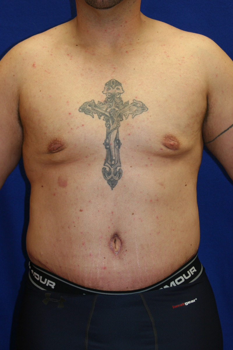 Man with a large cross tattoo on his chest, wearing dark Under Armour shorts, standing against a blue background.