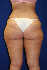 Rear view of a person standing against a blue background, wearing a pink bra and white underwear.