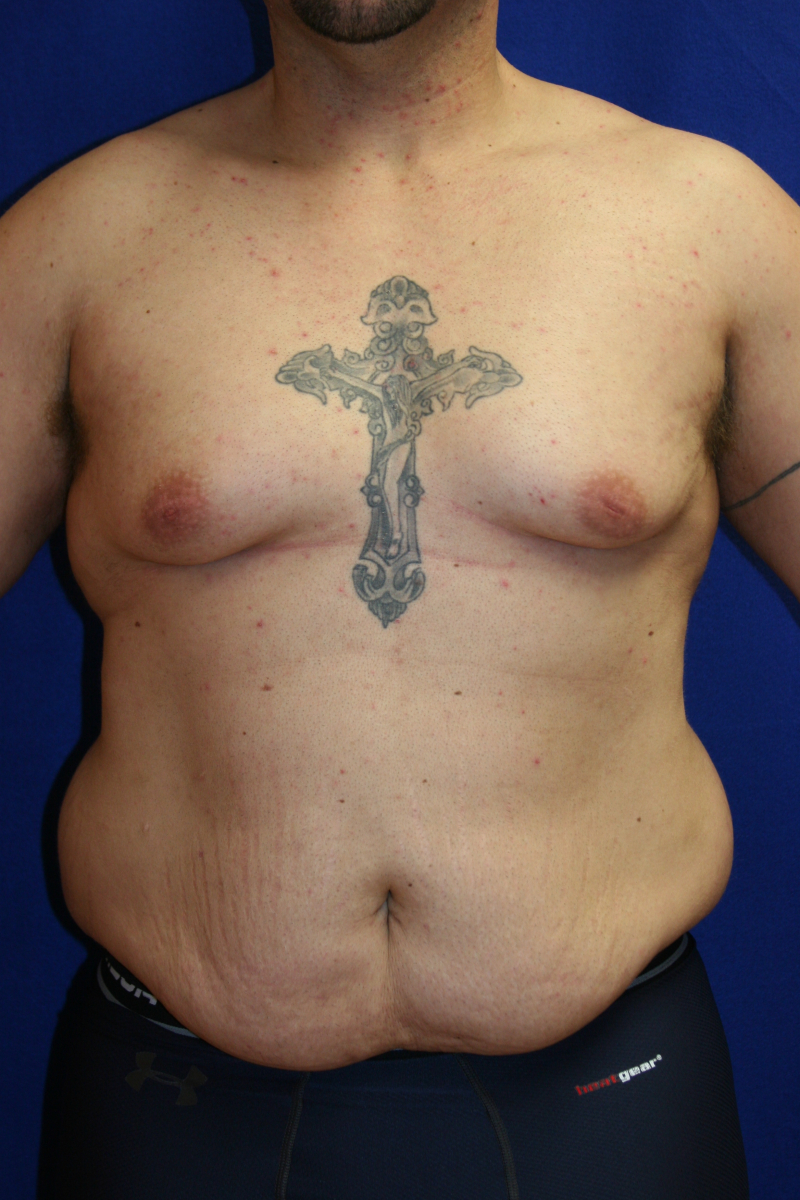 Shirtless person with a prominent cross tattoo on the chest.