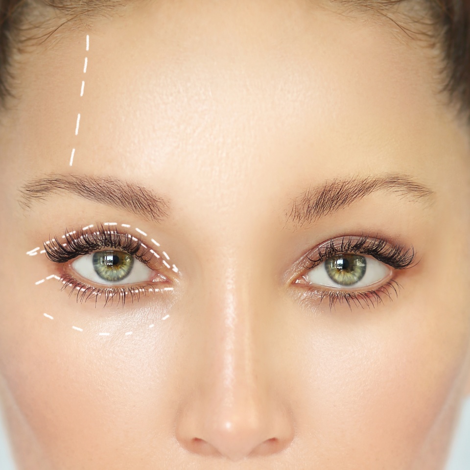 Eyelid Surgery.Brow Lift.upper eyelids.Forehead lift.Marking the face.Perforation lines on females face, plastic surgery concept.