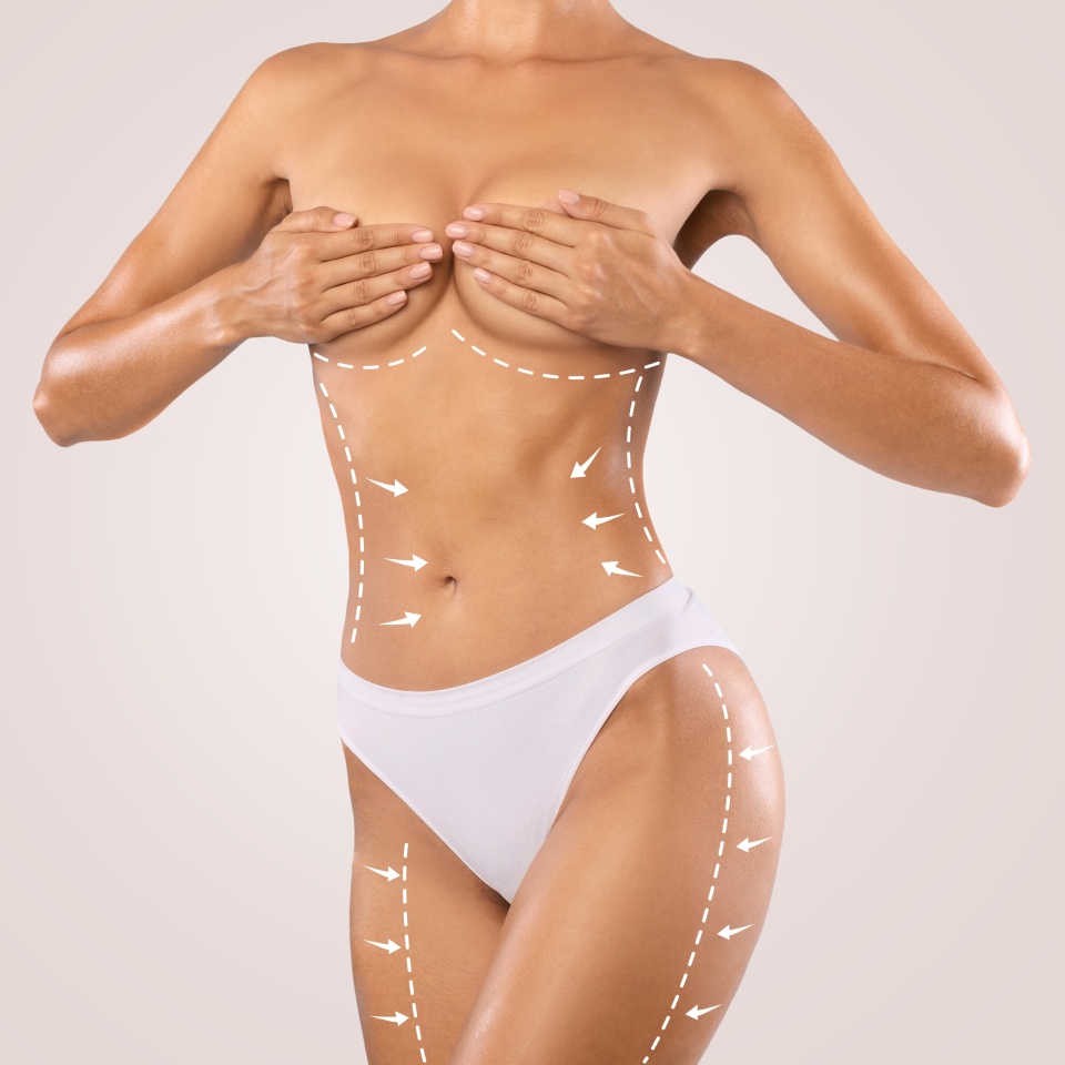 Beauty, Lifting And Tightening Concept. Closeup cropped view of young topless female model in white panties posing with massage lines and arrows on her full body, lady isolated on studio background
