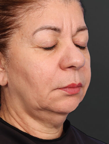 Profile view of a middle-aged woman with her eyes closed.